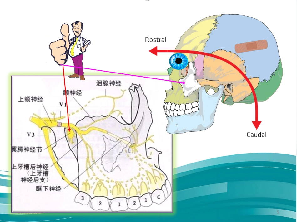鼻炎 3 穴 讲解精编版_第5页