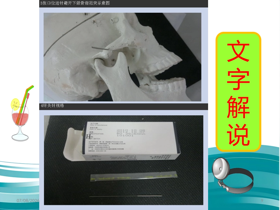 鼻炎 3 穴 讲解精编版_第9页