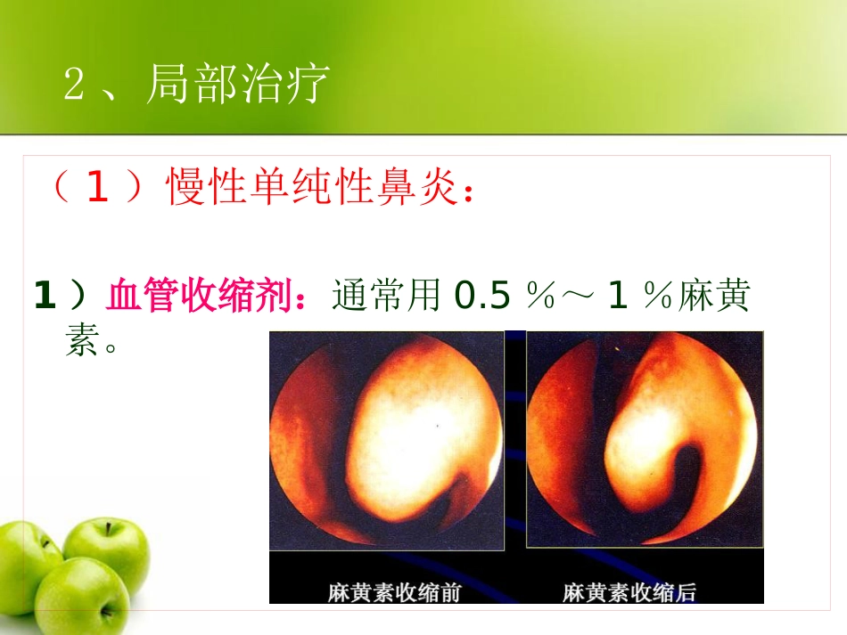 慢性鼻炎(3)_第10页