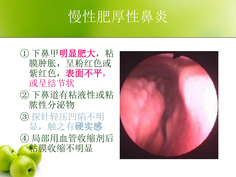 慢性鼻炎(3)_第8页