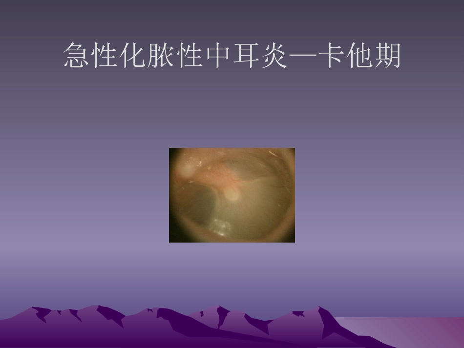急性化脓性中耳炎(4)_第13页