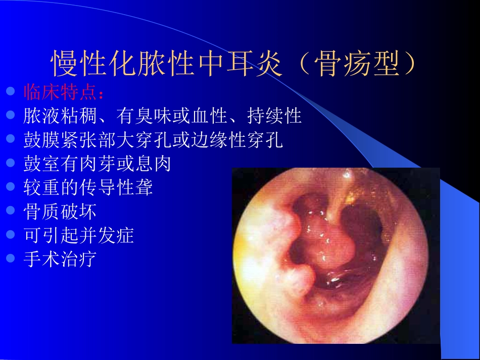 慢性化脓性中耳炎(4)_第12页