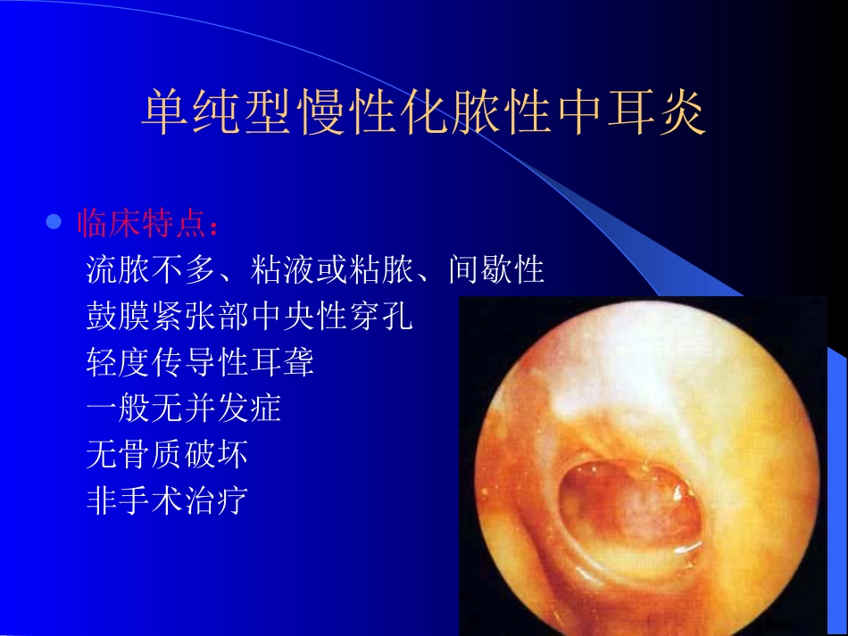 慢性化脓性中耳炎(4)_第8页