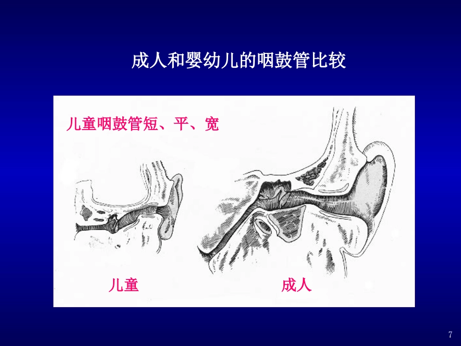 分泌性中耳炎(4)_第7页