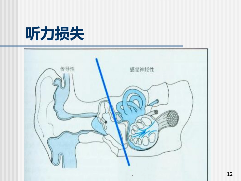 急性化脓性中耳炎(5)_第12页