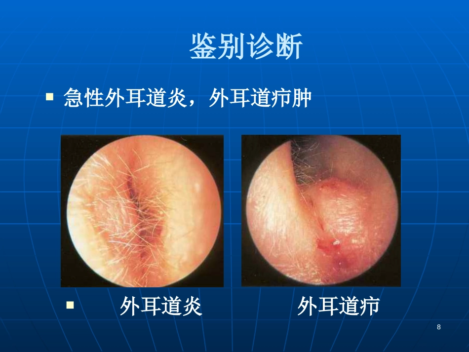急性化脓性中耳炎(6)_第8页