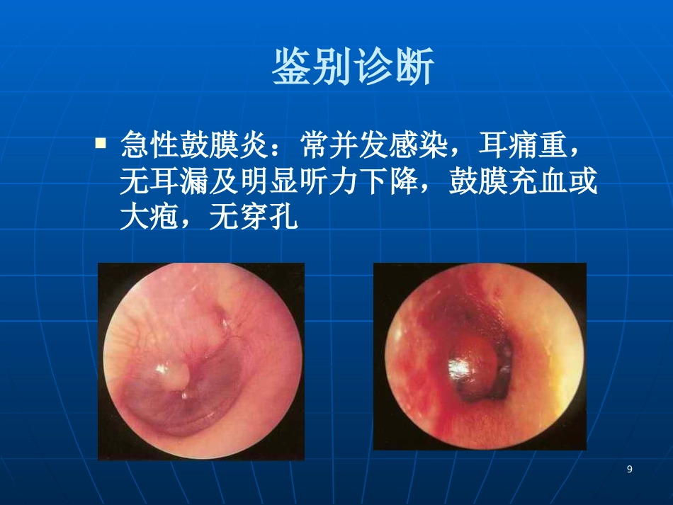 急性化脓性中耳炎(6)_第9页