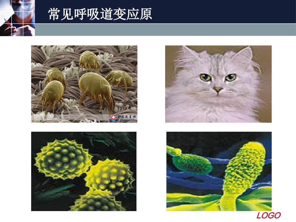 变应性鼻炎11_第13页