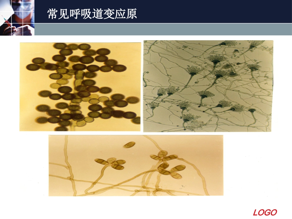 变应性鼻炎11_第14页