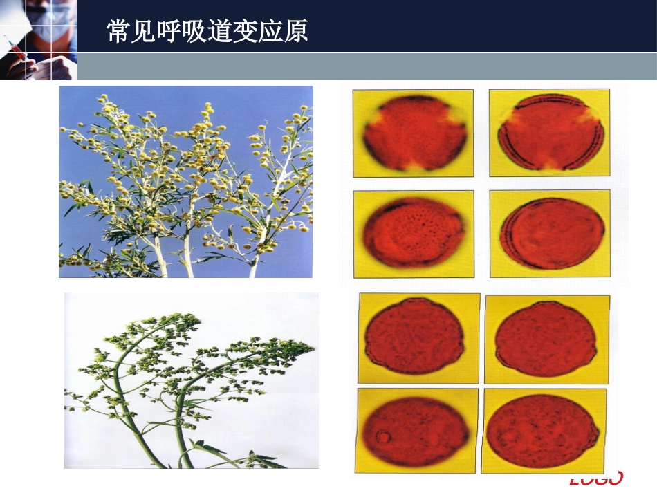 变应性鼻炎11_第15页