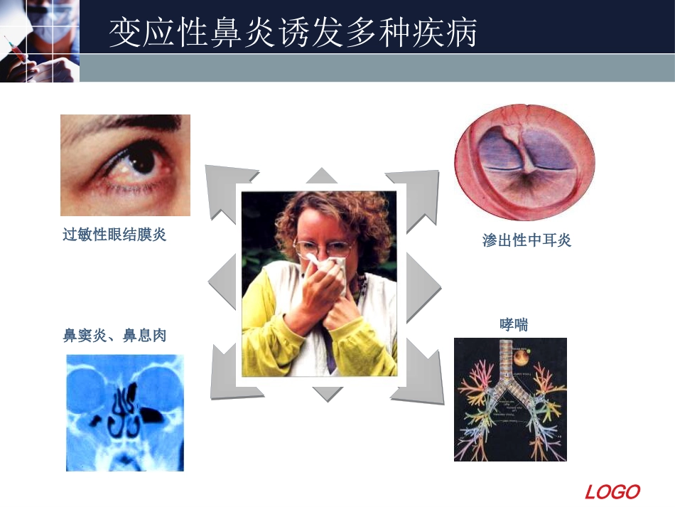 变应性鼻炎11_第6页