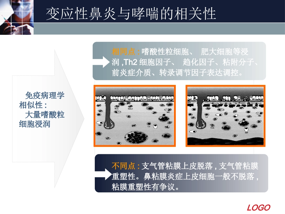 变应性鼻炎11_第9页