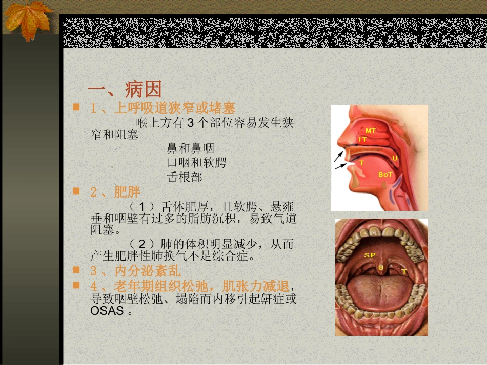 耳鼻咽喉头颈外科学21阻塞性睡眠呼吸暂停低通气综合症_第2页