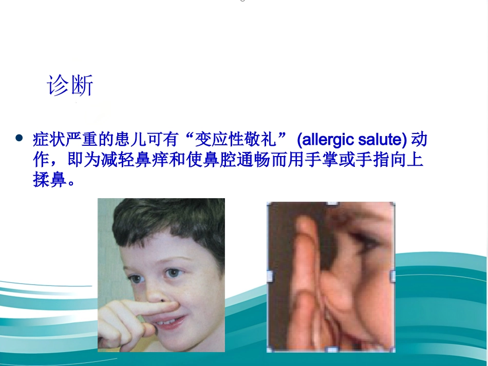 儿童变应性鼻炎诊疗专家共识(共25张PPT)_第6页