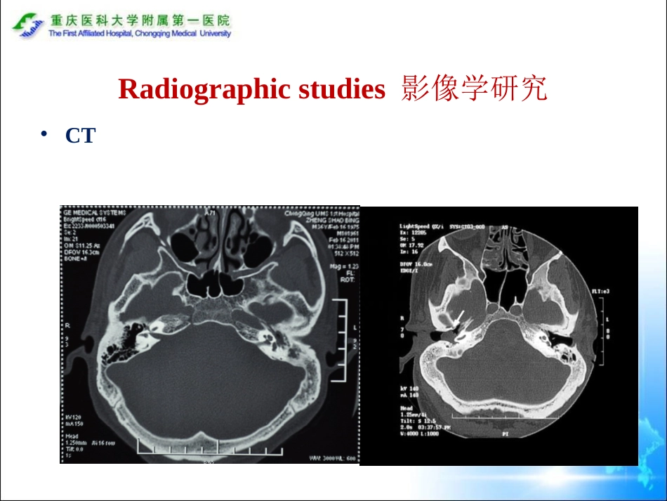 (耳鼻咽喉头颈外科学)43(参考翻译)CSOM_第11页