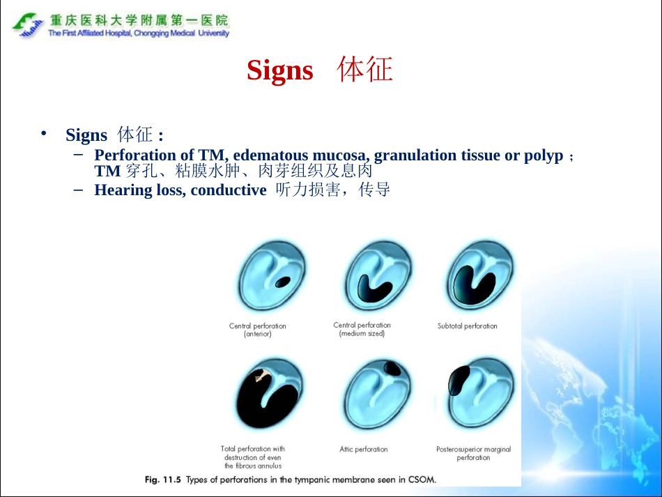 (耳鼻咽喉头颈外科学)43(参考翻译)CSOM_第8页
