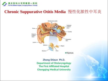 (耳鼻咽喉头颈外科学)43(参考翻译)CSOM