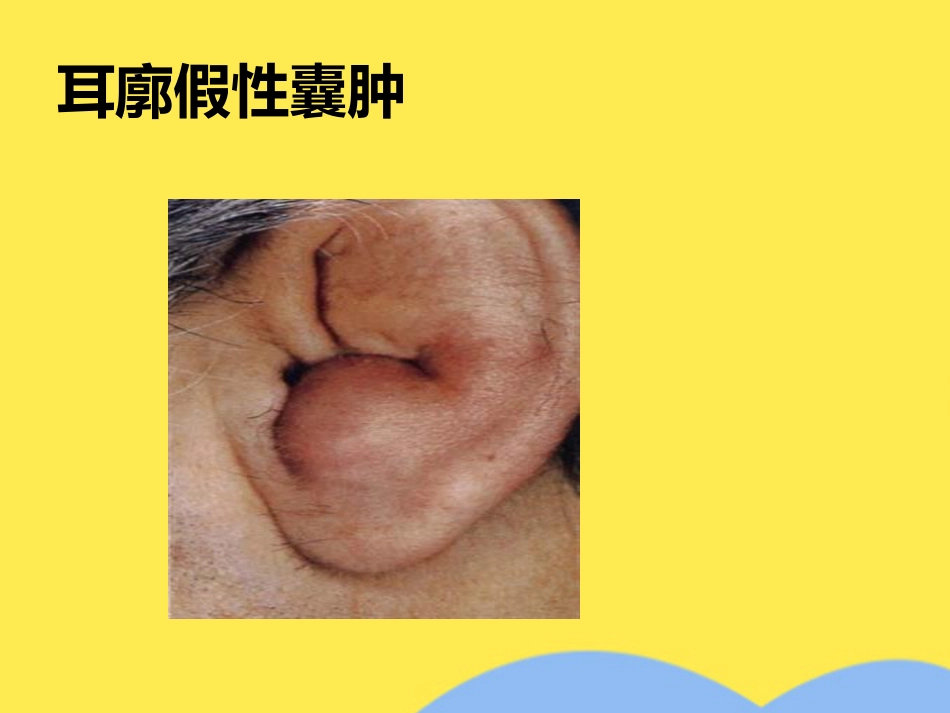 耳解剖及生理(“内耳”相关)共55张_第6页