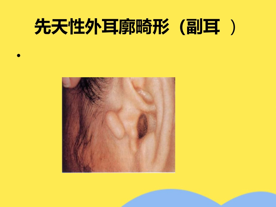 耳解剖及生理(“内耳”相关)共55张_第8页
