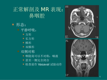 鼻咽癌MR诊断2018