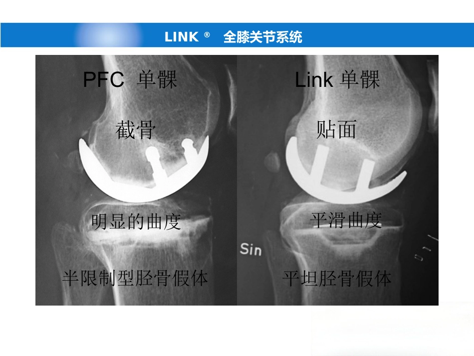 德国LINK单髁(新)产品操作-骨科关节手术_第7页