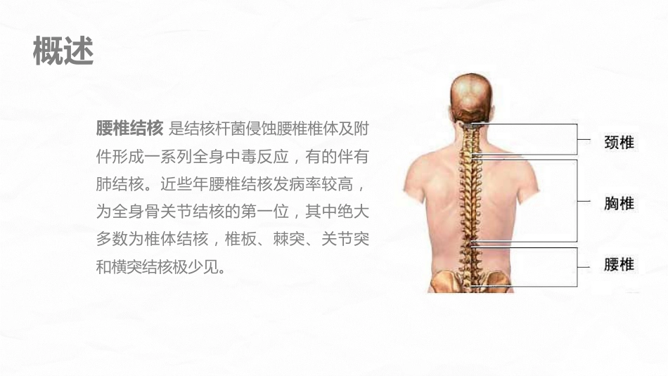 腰椎结核的围手术期护理_第4页