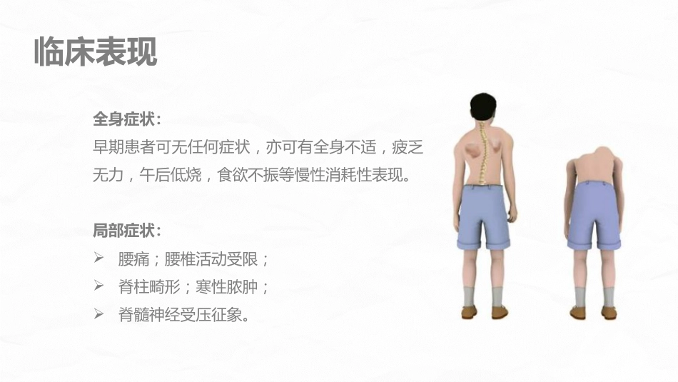腰椎结核的围手术期护理_第5页