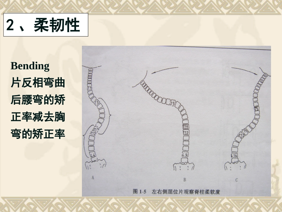 脊柱侧弯的治疗与对策_第5页