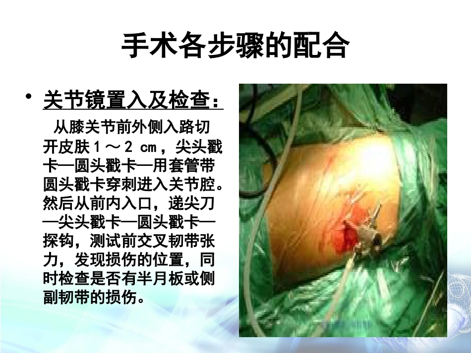 膝关节镜下前交叉韧带重建术手术配合_第15页