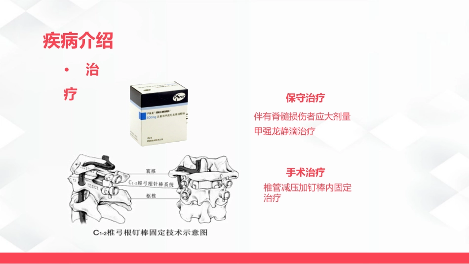 腰椎骨折的护理_第13页