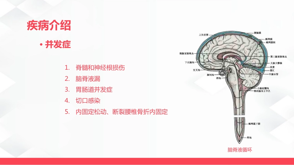 腰椎骨折的护理_第14页