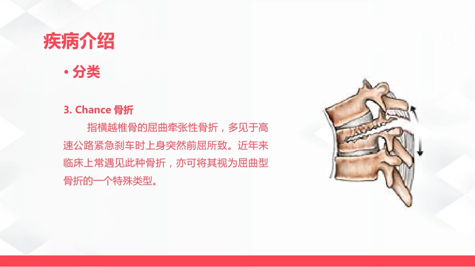 腰椎骨折的护理_第8页