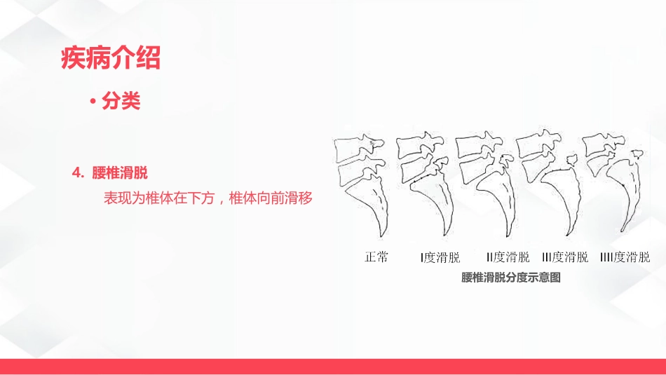 腰椎骨折的护理_第9页
