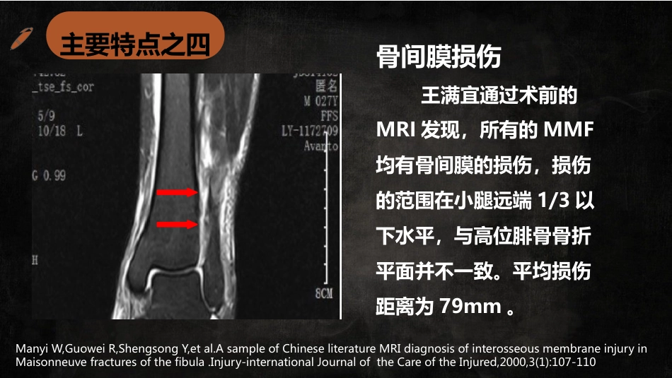 特殊类型踝关节汇总_第14页