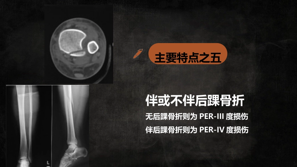 特殊类型踝关节汇总_第15页