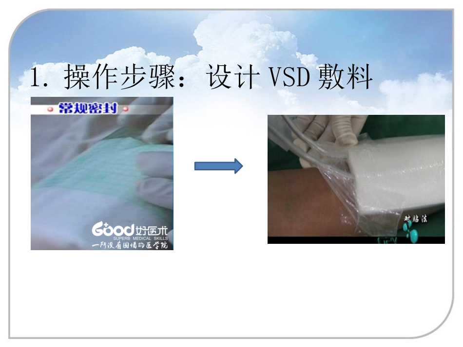 负压封闭引流技术在骨科中的应用_第9页