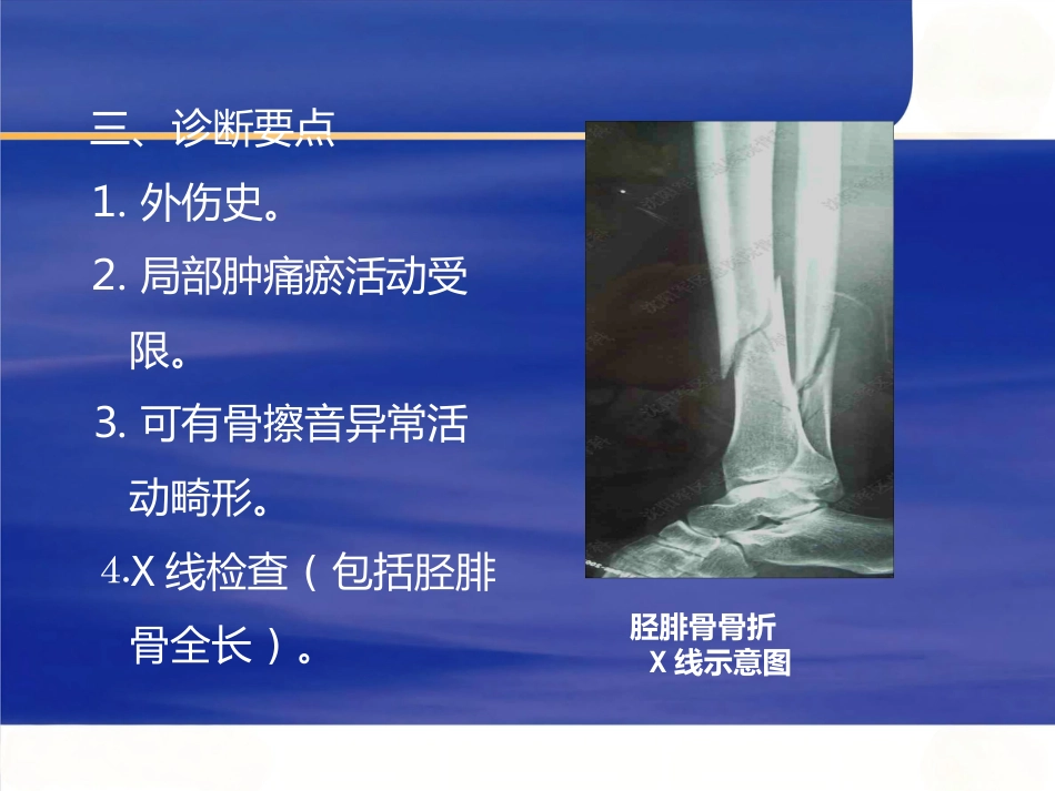 胫腓骨骨折_第11页