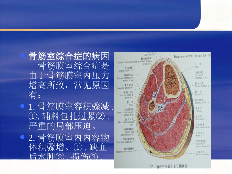 胫腓骨骨折_第14页