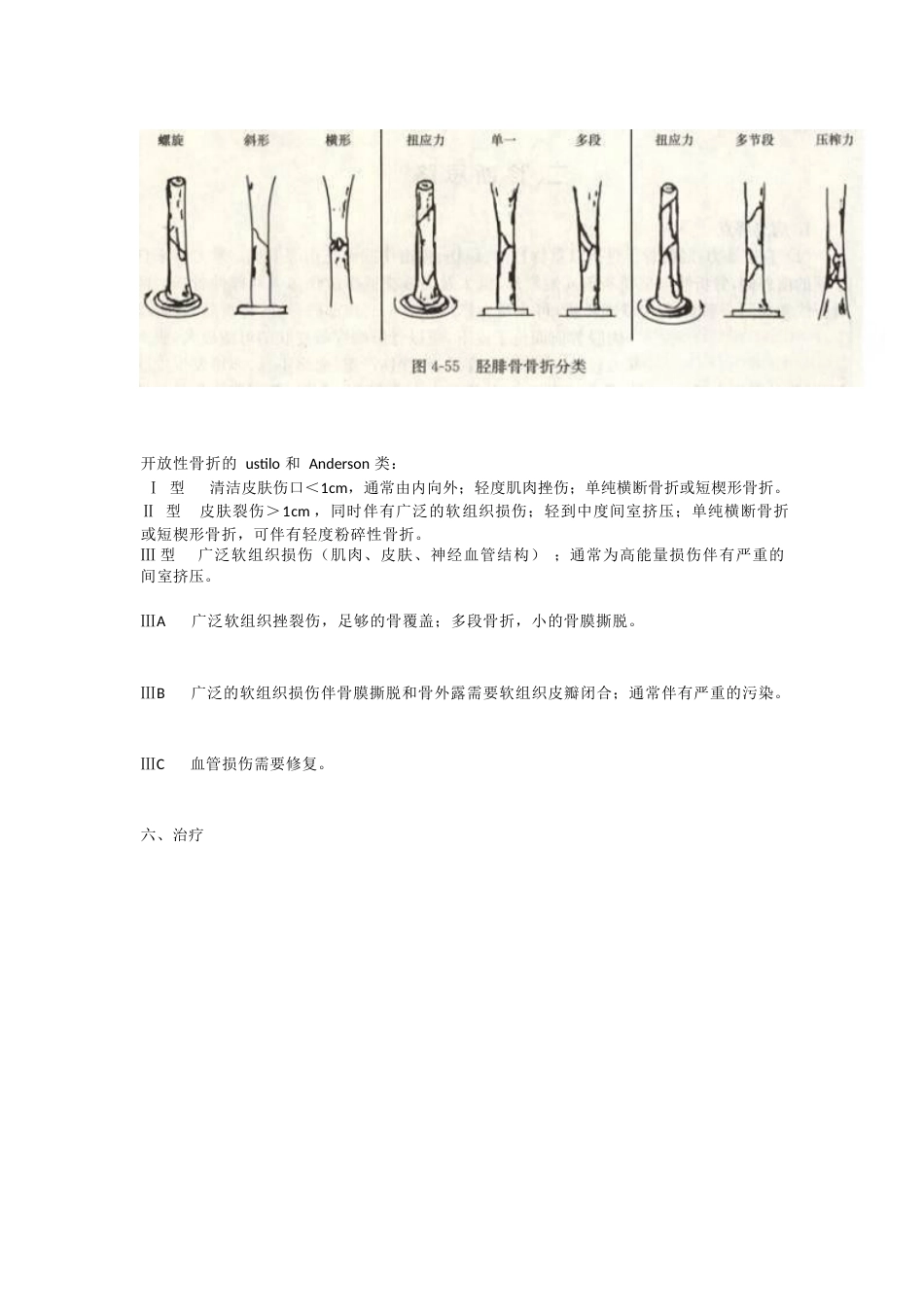 胫腓骨骨折的治疗方法_第9页