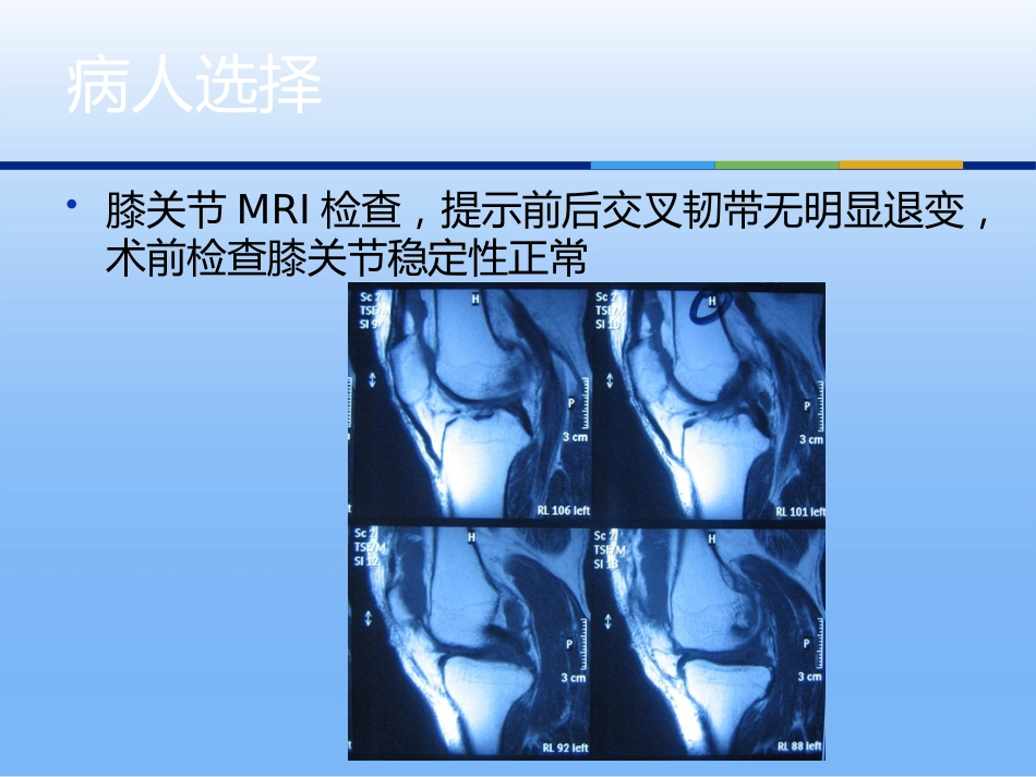 膝关节单髁置换二_第6页