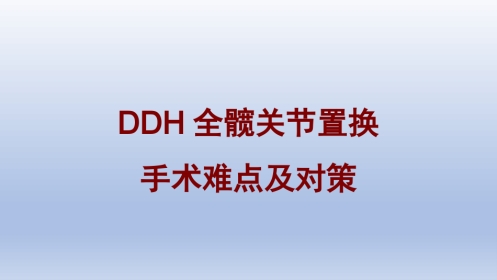 DDH全髋关节置换 手术难点及对策