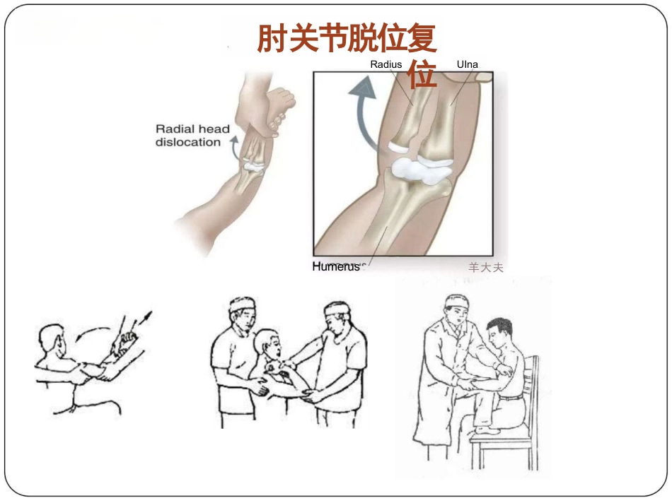 骨科体格检查_第15页