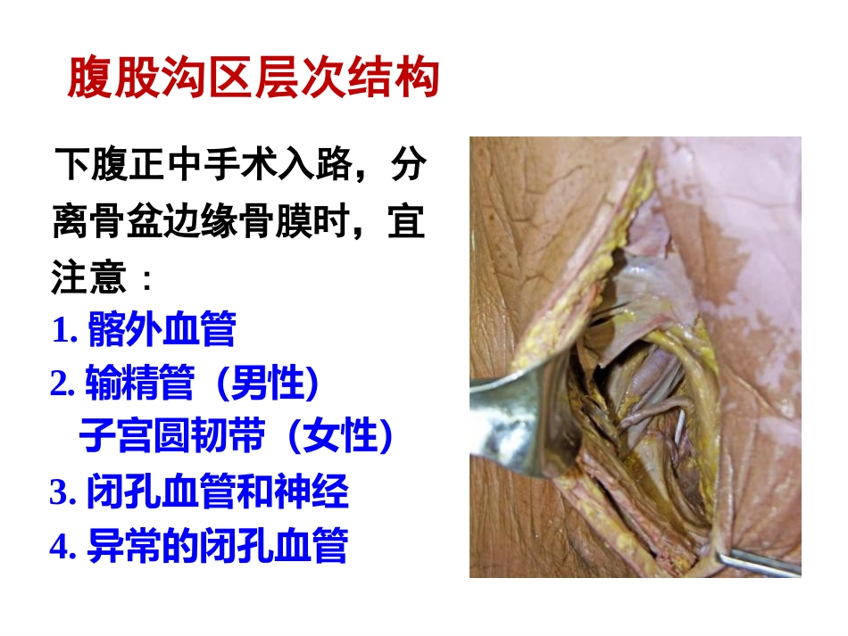 长海骨盆周围解剖_第15页