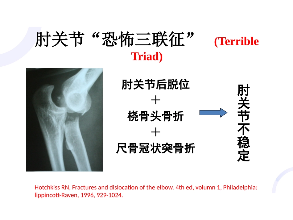 肘关节“恐怖三联征“_第3页