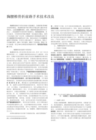 骨科教程：胸腰椎骨折前路手术技术改良