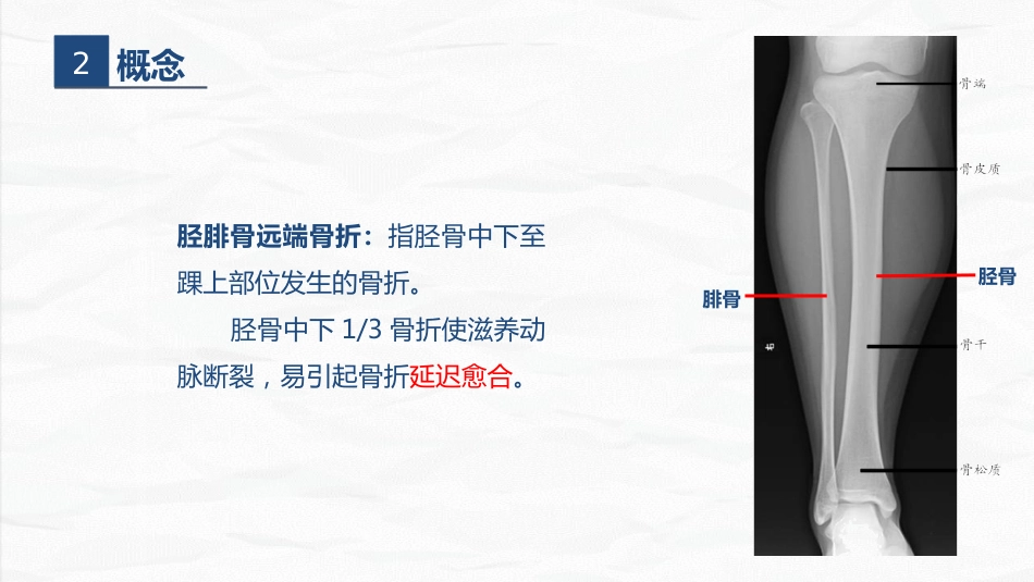 骨科-右胫腓骨远端骨折术合并骨盆骨折的护理查房_第5页