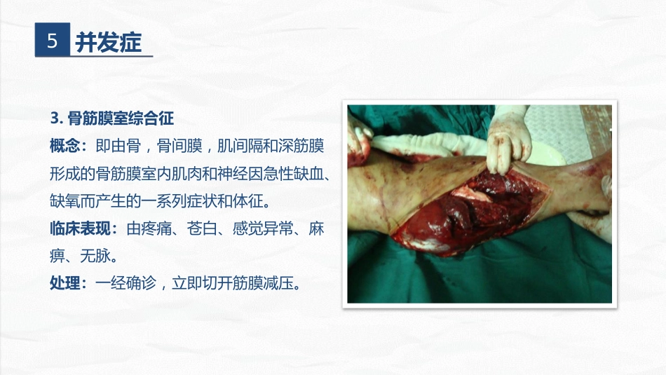 骨科-右胫腓骨远端骨折术合并骨盆骨折的护理查房_第9页