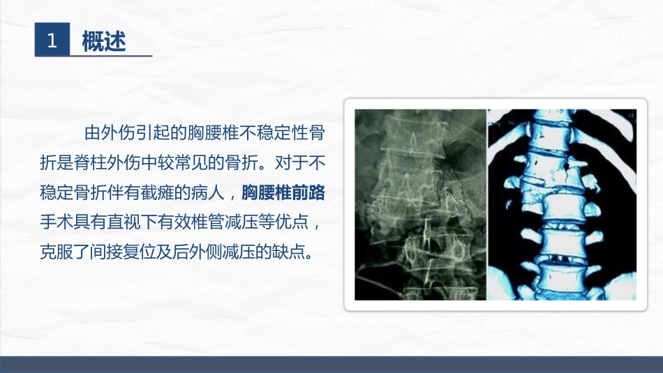 经前路腰椎手术护理配合_第12页