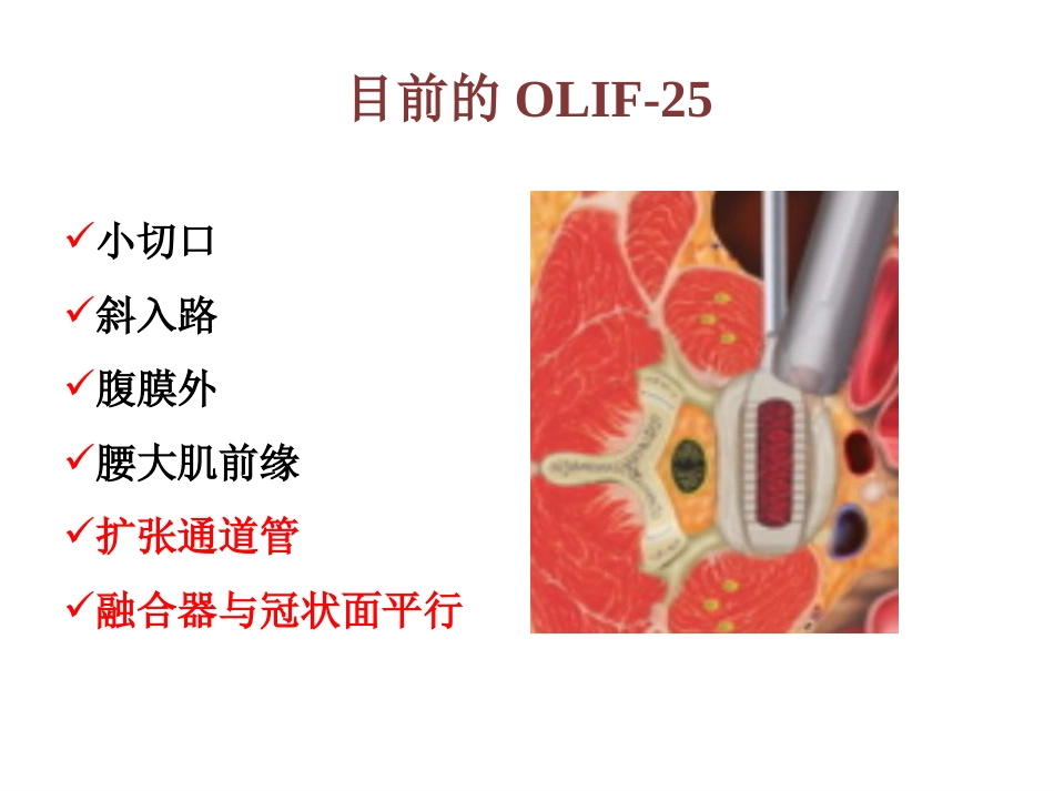 OLIF入路和相关解剖_第12页