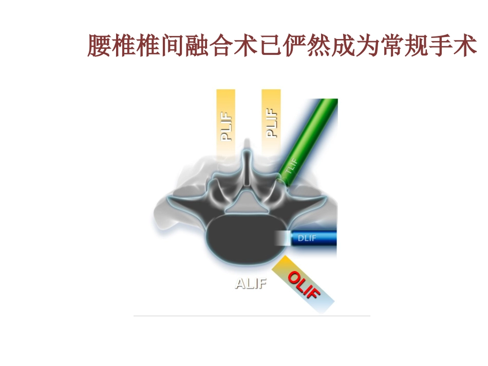 OLIF入路和相关解剖_第2页